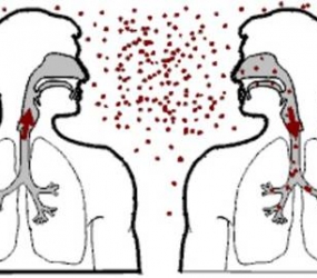 LƯU Ý KHI CHỮA BỆNH TẠI NHÀ CHO BỆNH NHÂN LAO PHỔI